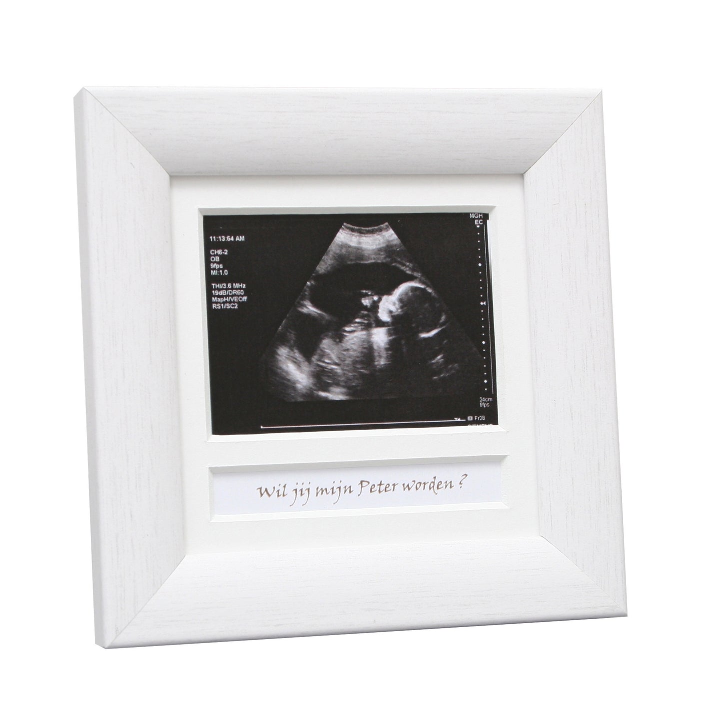 Fotolijst voor echo foto - Deknudt